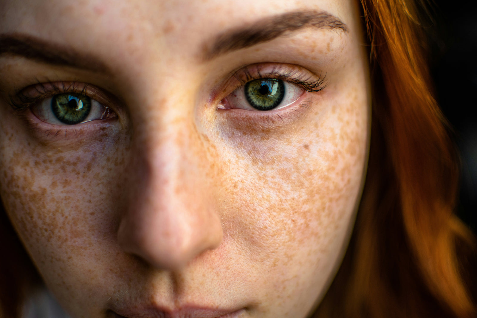 What Kind of Spots Do You Have? How to Identify and Fade Acne Marks, Hyperpigmentation, and Sun Damage